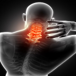 MRI Cervical Spine